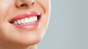 Wybielanie zębów u dentysty – co musisz wiedzieć?